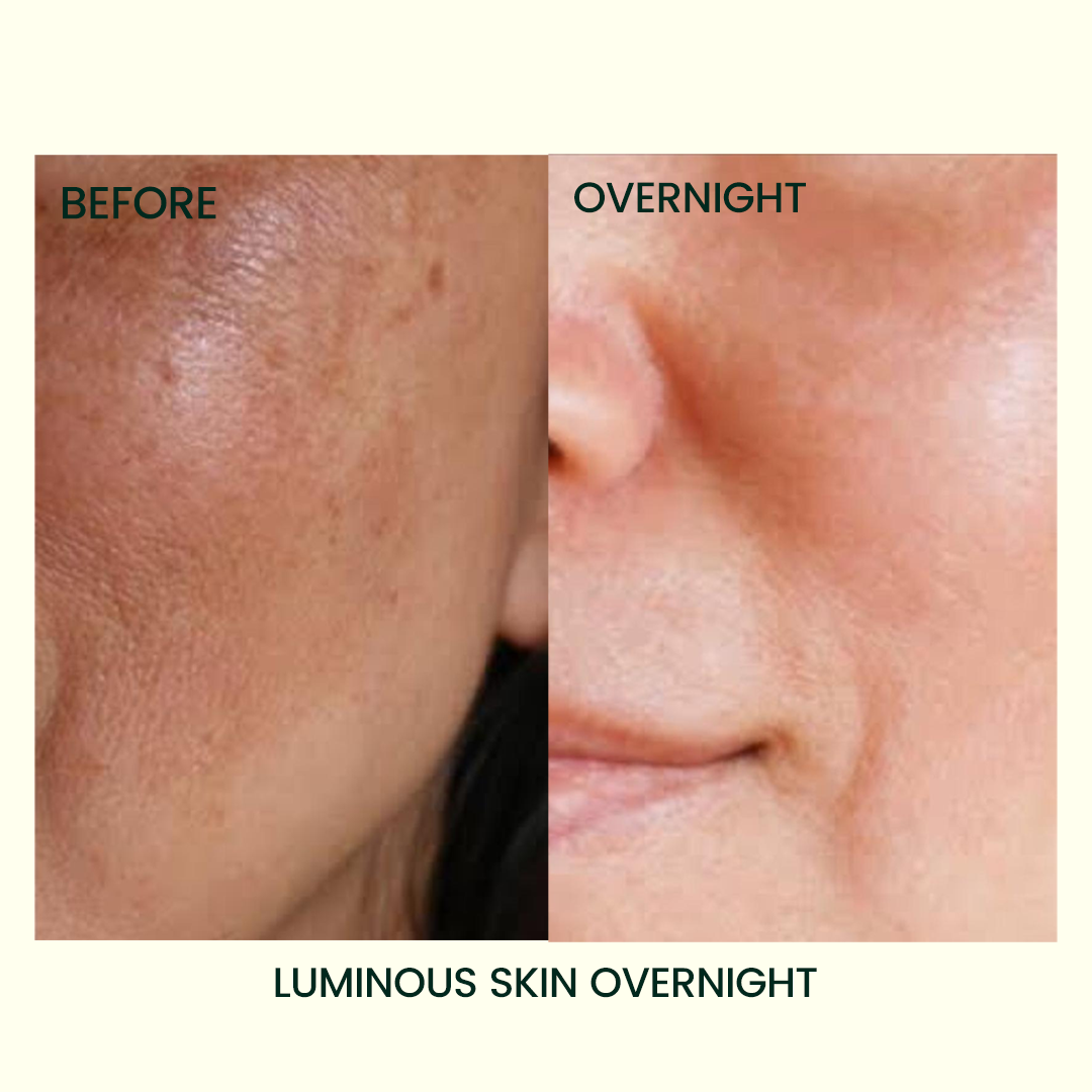 Overnight results of Bakuchiol Resurfacing Night Serum