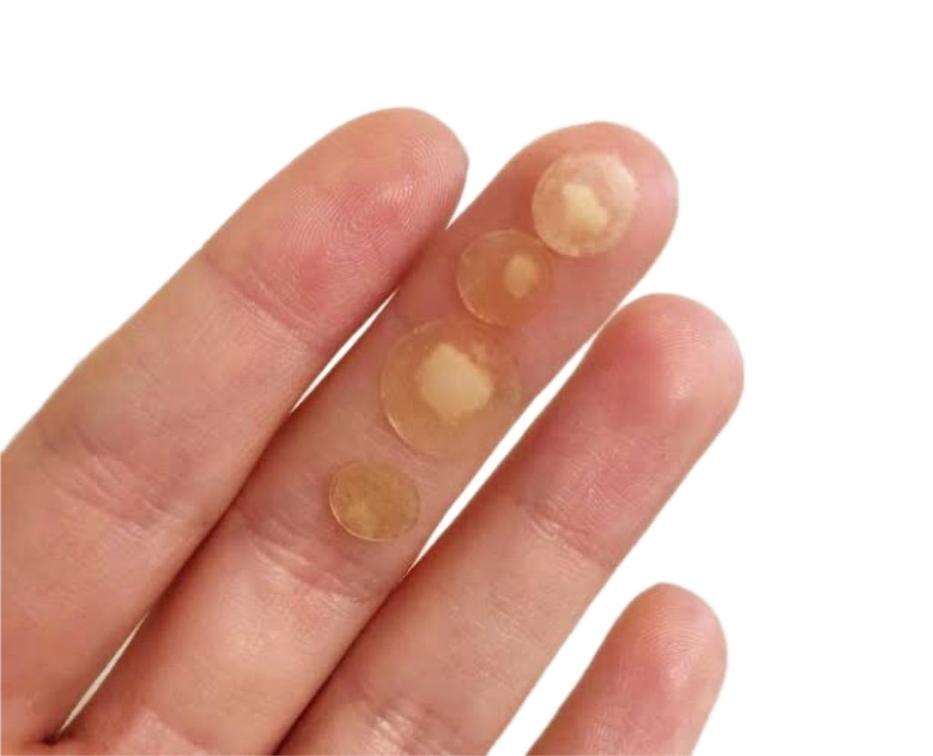 Pimple Gunk after applying Miracle Patch overnight