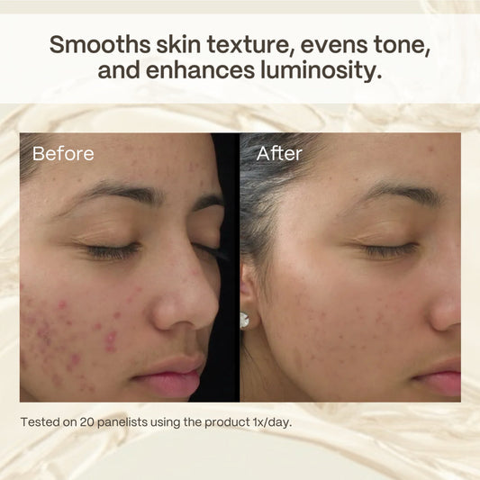 Glycolic Acid Benefits for Skin: What It Really Does (And Who Should Use It)