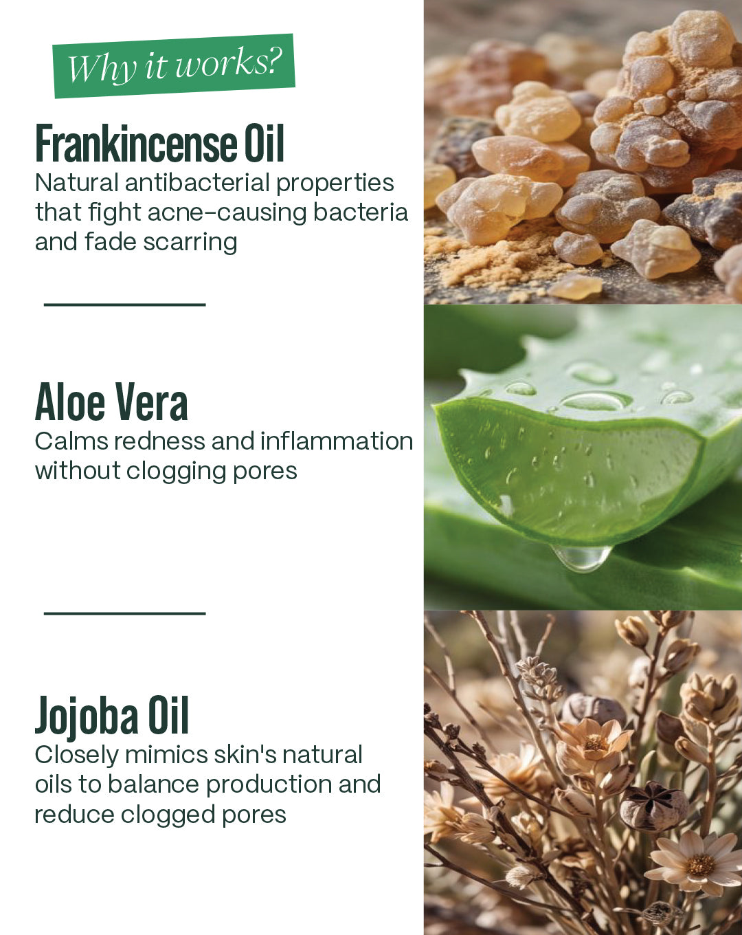 Blemish-Free Bundle — Routine For Acne-Prone Skin