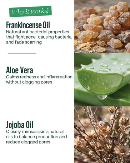 Blemish-Free Bundle — Routine For Acne-Prone Skin