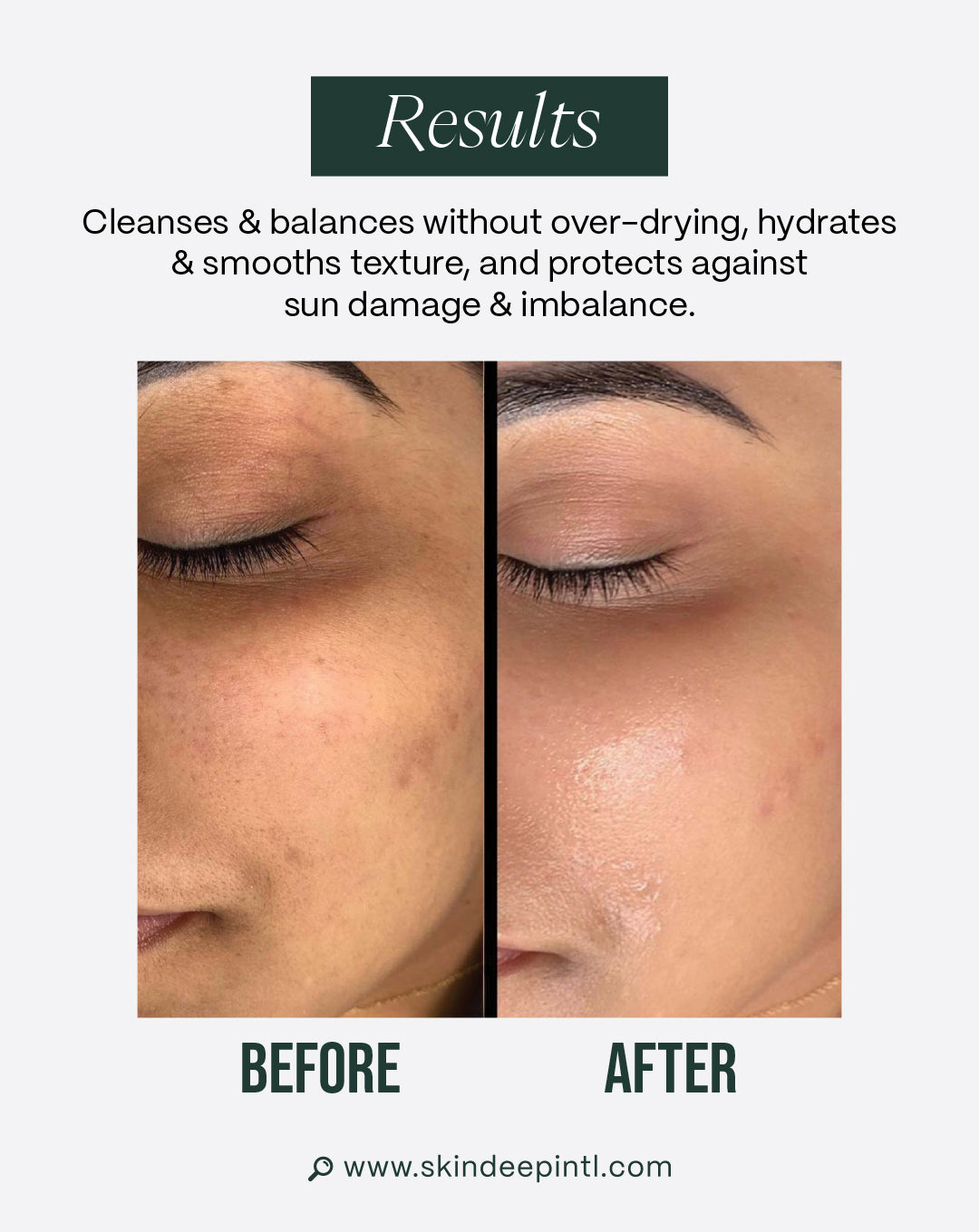Harmony Bundle — Routine For Combination Skin