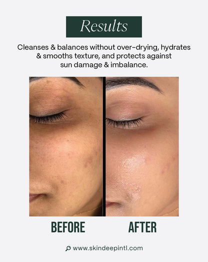 Harmony Bundle — Routine For Combination Skin