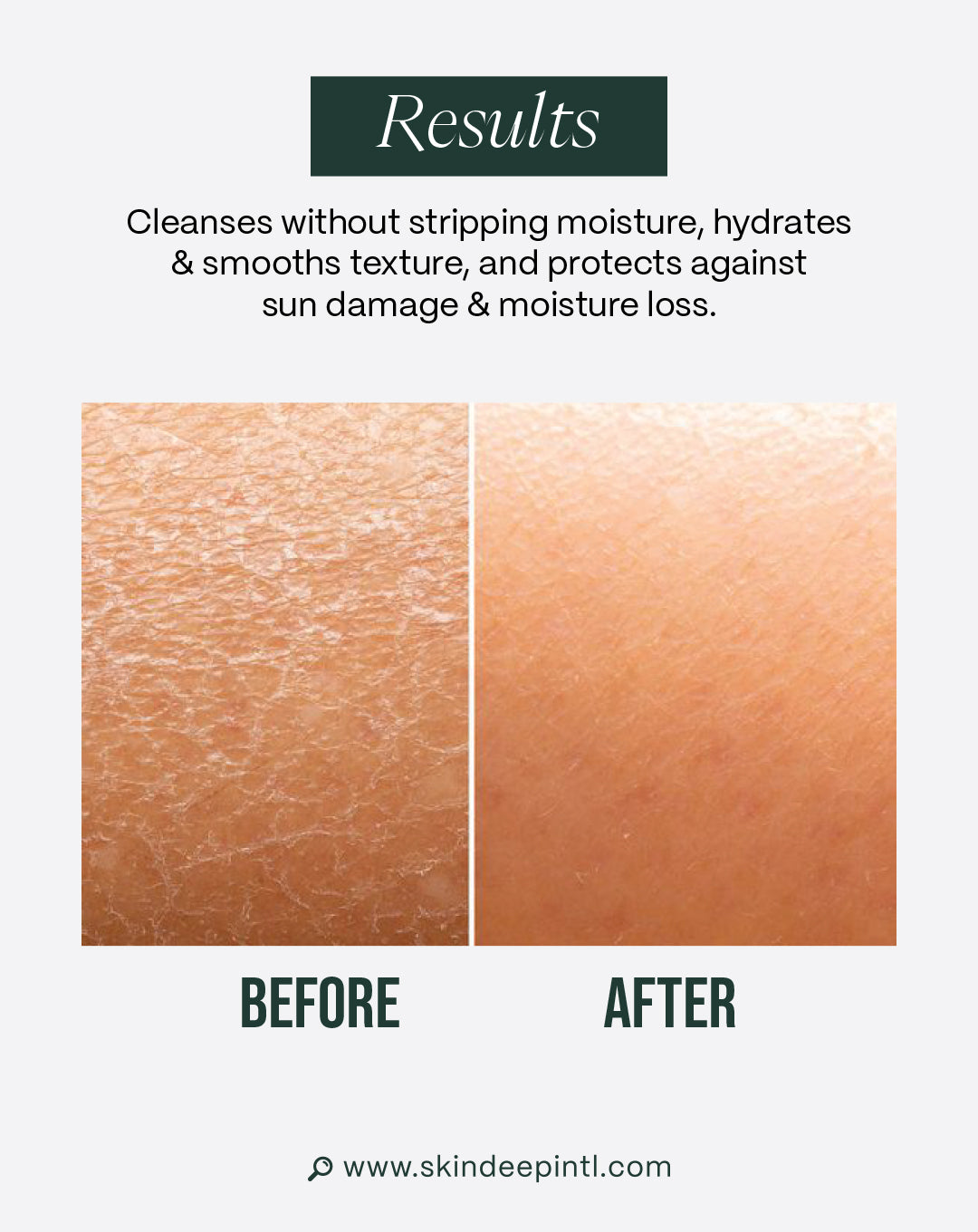 Hydration Ritual Bundle — Routine For Dry Skin