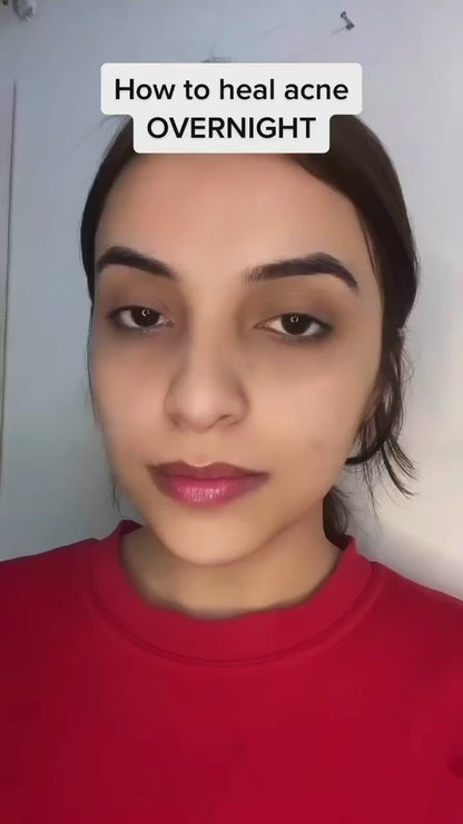 MIRACLE PATCH - Acne Healing & Blemish Spot Treatment