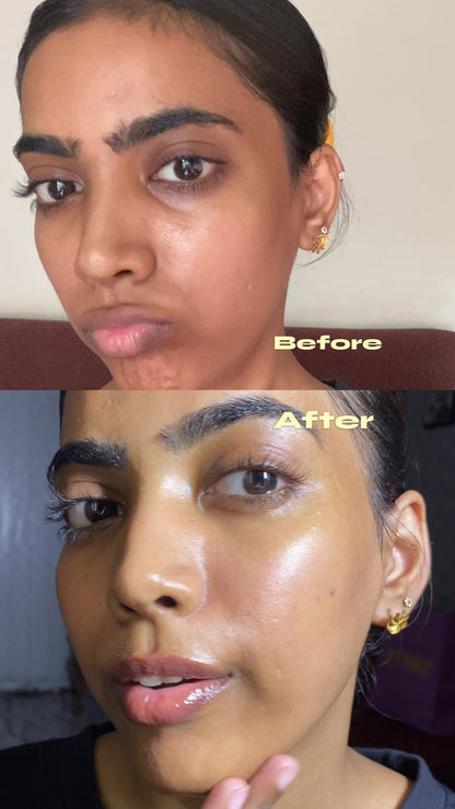 Skin Revival Bundle — For Tired & Dehydrated Skin